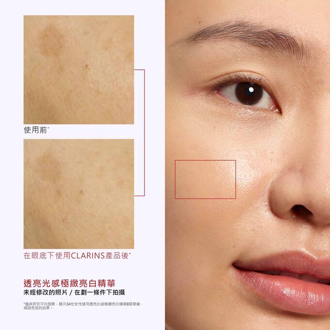 一位女性使用產品前後的眼周特寫，展示使用透亮光感極緻亮白精華後能減退色斑。